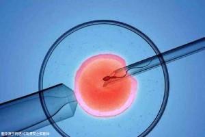 试管供卵公司